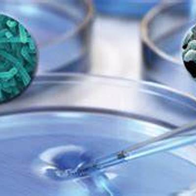 Timeline: Història de de microbiologia