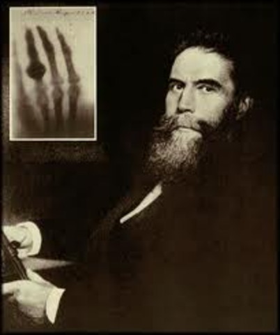 Wilhelm Roentgen Discovers X-rays