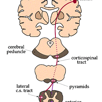 Timeline: Las alteraciones de la neurona motora superior