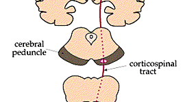 Timeline: Las alteraciones de la neurona motora superior
