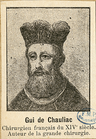 Guy DE Chauliac (1300- 1368)