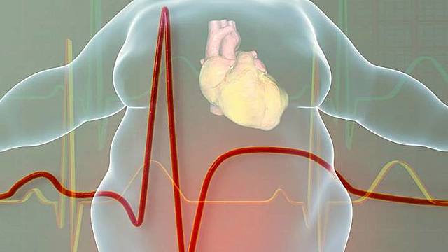 ENSA registra a México con cifras elevadas de sobrepeso y obesidad