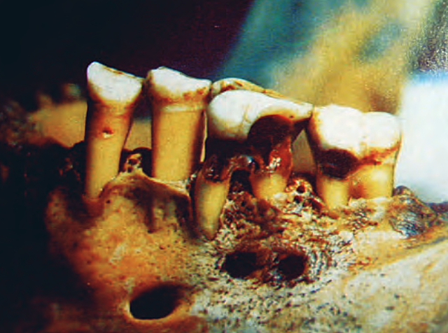 Historia de la Odontología de Egipto