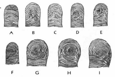 Dr. Johannes Purkinje E.