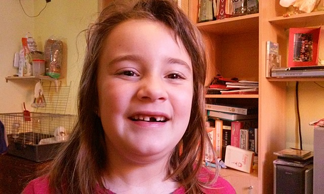 Em cau la primera dent