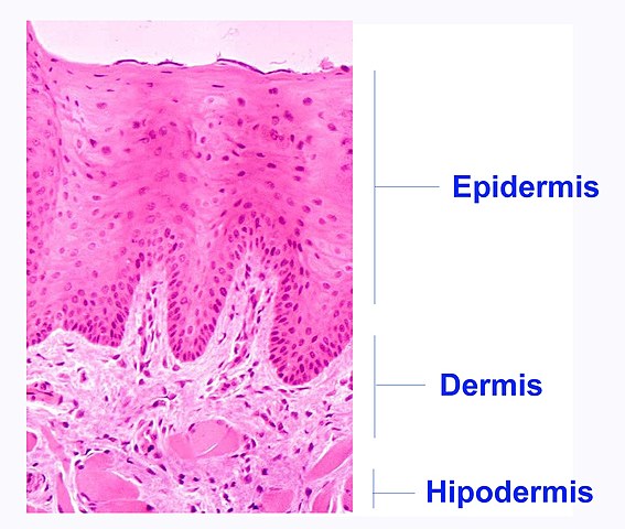 Dermis
