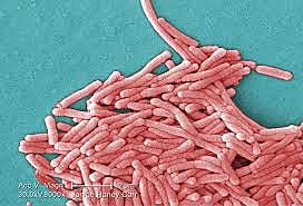 En filadelfia (Estados Unidos) aparece la enfermedad de los legionarios.