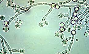 Se incluye el concepto de dimorfismo en el reino fungi
