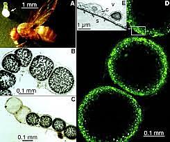Thiomargarita namibiensis