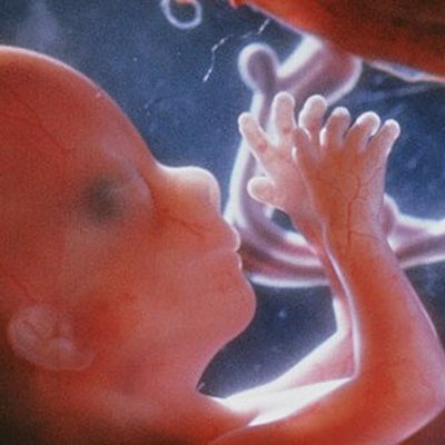 Timeline: Prenatal Timeline