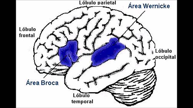 LOCALICIONALISMO CEREBRAL- BROCA