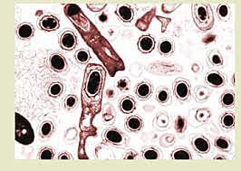 Descubrimiento por Koch de las esporas de Carbunco