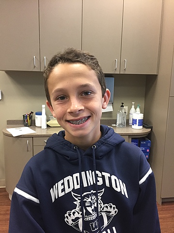 Me pusieron frenillos