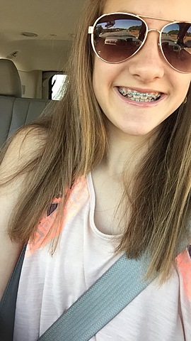 Tuve frenillos cuando yo tenía trece años.