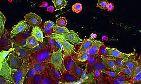 Re programación celular