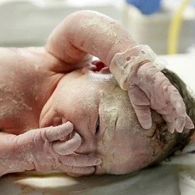 Timeline: Embriología Cutánea.