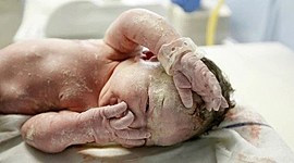 Timeline: Embriología Cutánea.