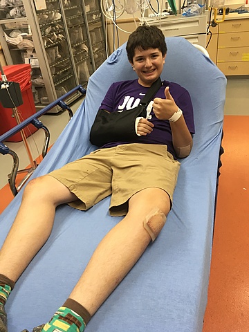 En dos mil y diez y nueve rompe mi primer hueso. Rompe mi brazo derecho. Choque con un arbolito en mi bicicleta.