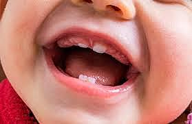Primeros dientes
