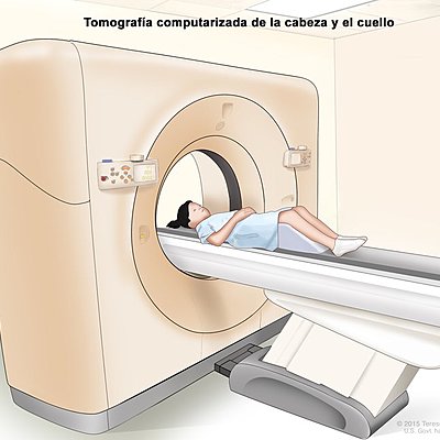 Timeline: TC (Tomografía computarizada)