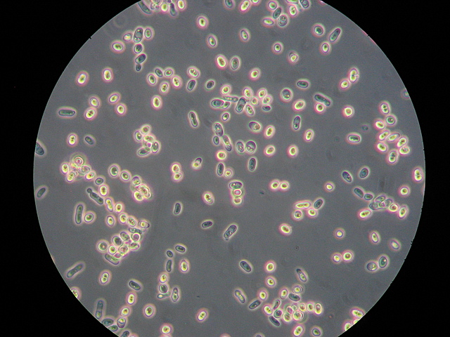 POSIBLE PRIMER BIORREACTOR