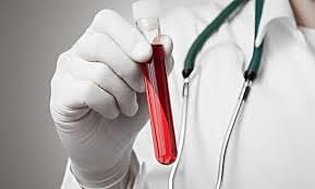 AVANCES EN LA PROFILAXIS DEL SIDA