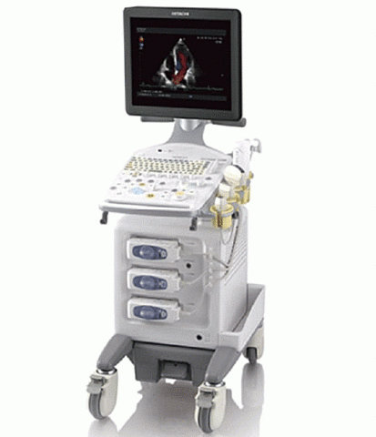 Primer equipo a color