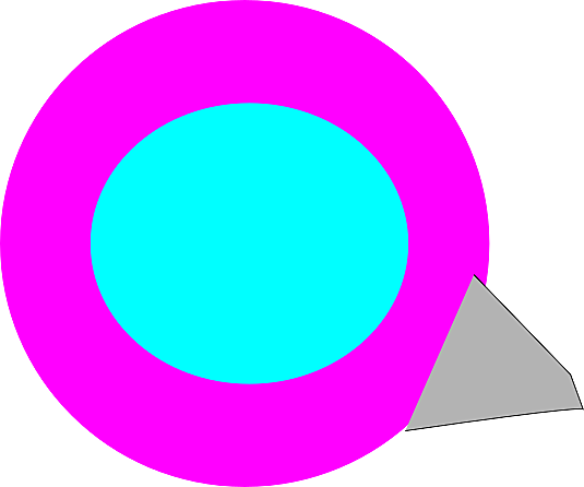 esponja anticonceptiva