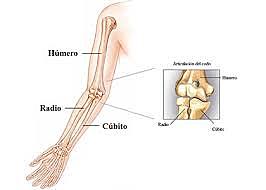 Fractura del humero