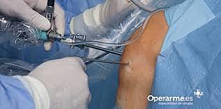 Operación de Rodilla