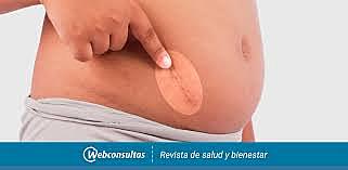 Operación de Apendice