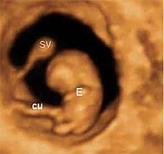 Desarrollo del feto en la semana 8: La vértebras crecen y rodean la médula