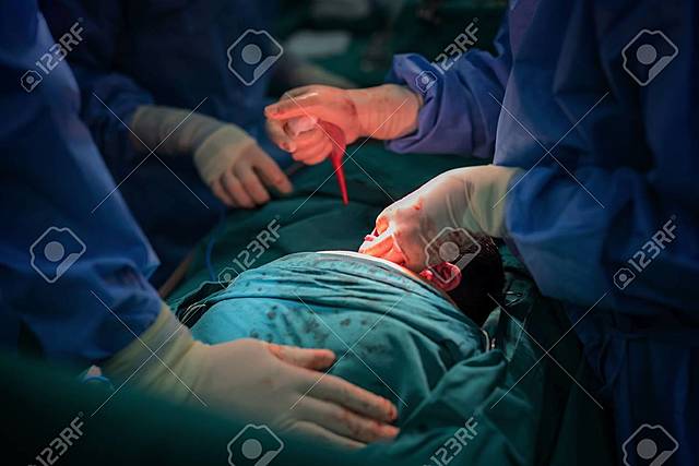 Operación a temprana a 2 meses de nacer