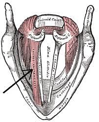 Pliegues ariepiglóticos