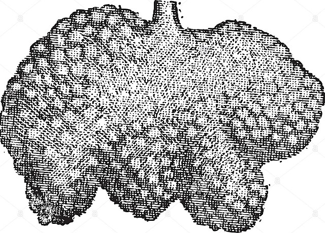 Glandulas duodenales (Brunner)