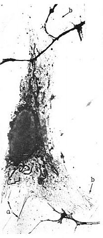 Primera fotografía de una célula