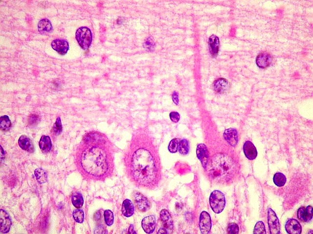Descubrimiento de células de Purkinie