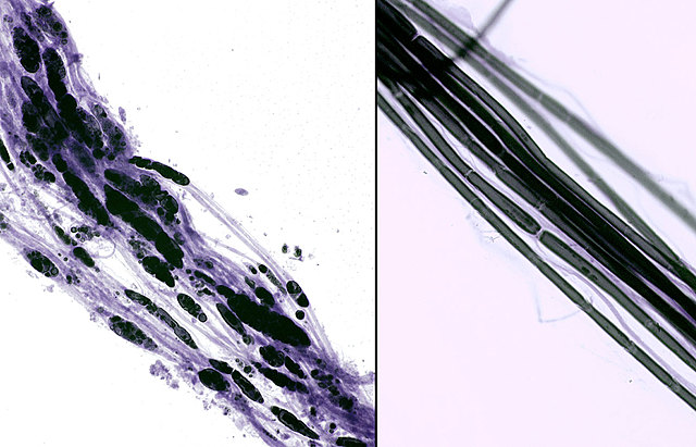 Funciones de las fibras nerviosas simples.