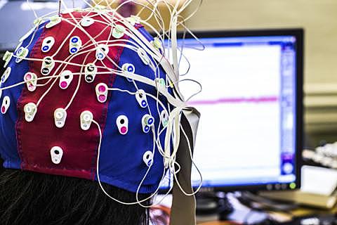 Electroencefalograma