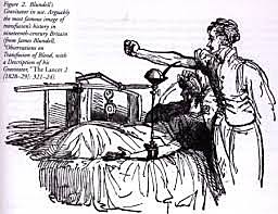 impelloor y gravitor (James blundel)