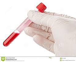 comprobación de sangre (ottenberg)