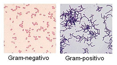 Tinción Gram