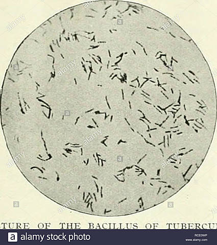 Koch anunció que había descubierto el tratamiento para la enfermedad: la tuberculina.