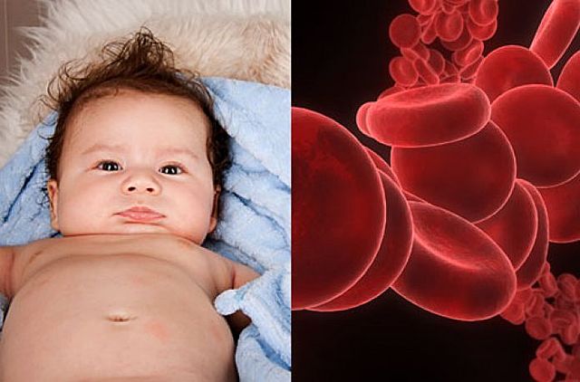 Landsteiner y Wiener dieron a conocer la causa de la eritroblastosis fetal que se produce cuando el padre es Rh positivo y la madre Rh negativo