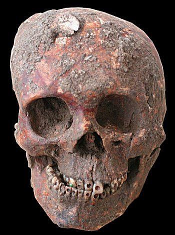 Craneo Con Incrustaciones