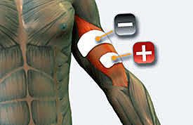 Guillaume Benjamín Amand Duchenne