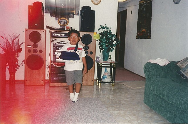 Mi "accidente" jugando