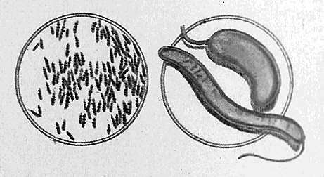 Descibrimiento del bacilo de la tuberculosis