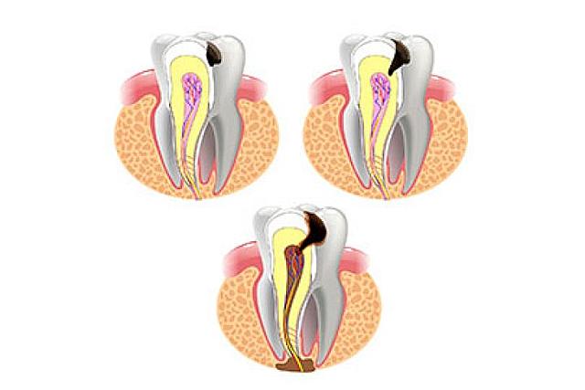 Odontología restauradora actual