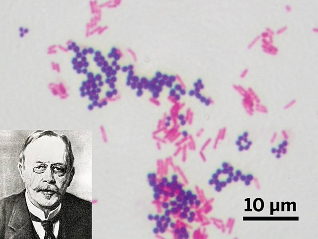Tinción de Gram: Christian Gram